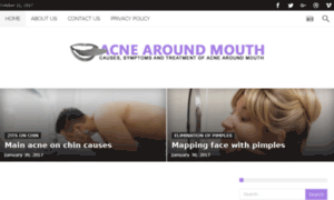 Acnearoundmouth.net thumbnail