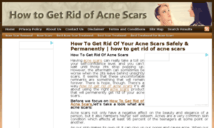 Acnescartreatmenttips.net thumbnail