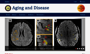 Aginganddisease.org thumbnail