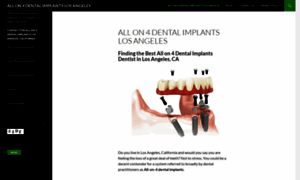 Allon4dentalimplantsla.com thumbnail