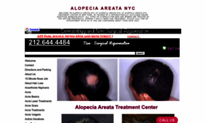 Alopeciaareatanyc.org thumbnail