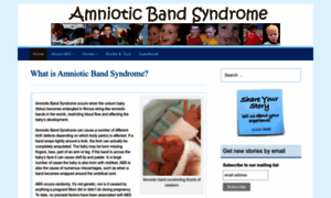 Amnioticbandsyndrome.com thumbnail