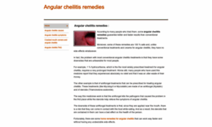 Angular-cheilitis-remedies.weebly.com thumbnail