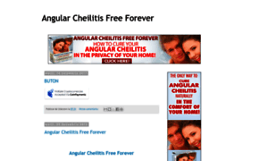 Angularcheilitis-free-forever.blogspot.ro thumbnail