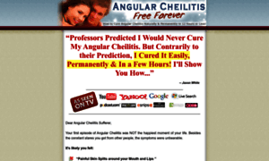 Angularcheilitisfreeforever.com thumbnail