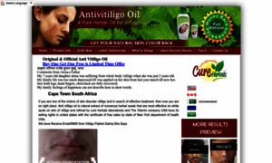 Antivitiligooil.com thumbnail