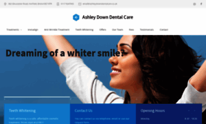 Ashleydowndentalcare.co.uk thumbnail