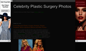 Celebrityplasticsurgerypics.blogspot.com thumbnail