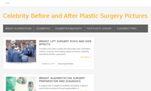 Celebritysurgery.us thumbnail