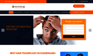 Chandigarhhairtransplantation.com thumbnail