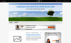 Comoquitarlasestrias.over-blog.com thumbnail