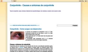 Conjuntivite-alergica.blogspot.com thumbnail