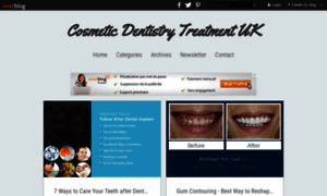 Cosmetic-dentistry-treatment-uk.over-blog.com thumbnail