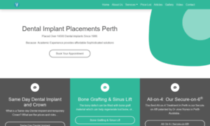 Dental-implant-placements-perth.com thumbnail