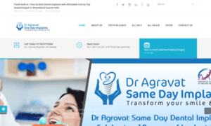 Dentalimplant.agravat.com thumbnail