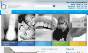 Dentalimplants.me.uk thumbnail