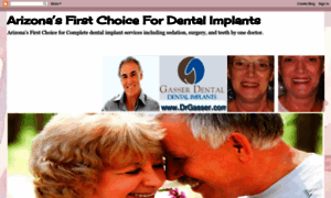 Dentalimplantsaz.blogspot.in thumbnail