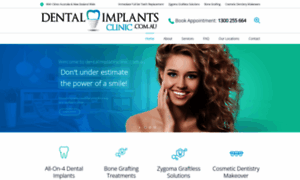 Dentalimplantsclinic.com.au thumbnail