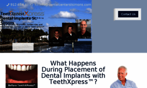 Dentalimplantsstsimons.com thumbnail