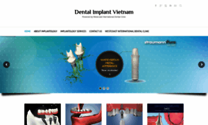 Dentalimplantvietnam.com thumbnail