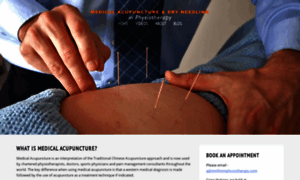 Dryneedling-acupuncture.ie thumbnail