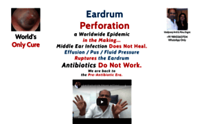 Eardrumperforation.com thumbnail