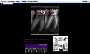 Endodontiaavancada.blogspot.com.br thumbnail