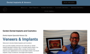 Gordondentalimplantsandcosmetics.com thumbnail