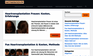 Haartransplantation.biz thumbnail