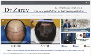 Hairtransplantation.bg thumbnail