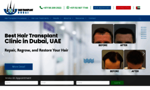 Hairtransplantdubai.com thumbnail