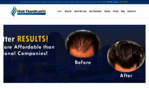 Hairtransplantsorlando.com thumbnail