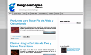 Hongosenlospies.blogspot.com thumbnail