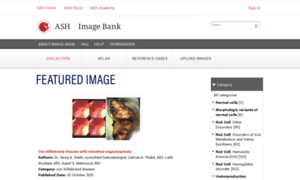 Imagebank.hematology.org thumbnail