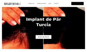 Implant-de-par-turcia.webflow.io thumbnail