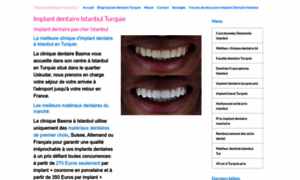 Implant-dentaire-istanbul.fr thumbnail