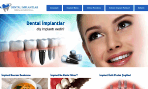 Implantdisfiyatlari.gen.tr thumbnail