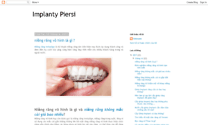 Implanty-piersi.net thumbnail