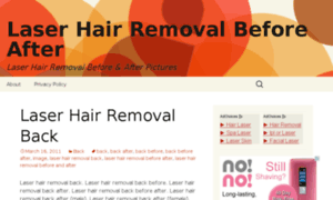 Laserhairremoval-beforeafter.com thumbnail