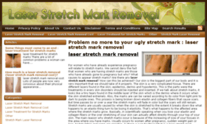 Laserstretchmarkremovalguide.net thumbnail