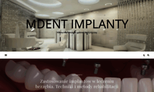 Mdent-implanty.pl thumbnail
