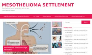 Mesothelioma-settlement.eu thumbnail