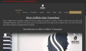 Microfolliclehairtransplant.com thumbnail