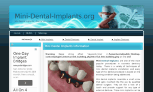 Mini-dental-implants.org thumbnail