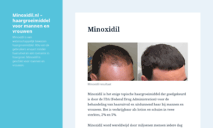 Minoxidil.nl thumbnail