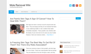 Moleremovalwiki.com thumbnail