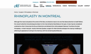 Montrealrhinoplasty.com thumbnail