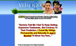 Naturalvitiligotreatmentsystem.com thumbnail