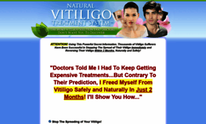 Naturalvitiligotreatmentsystem.net thumbnail