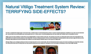 Naturalvitiligotreatmentsystems.blogspot.com thumbnail